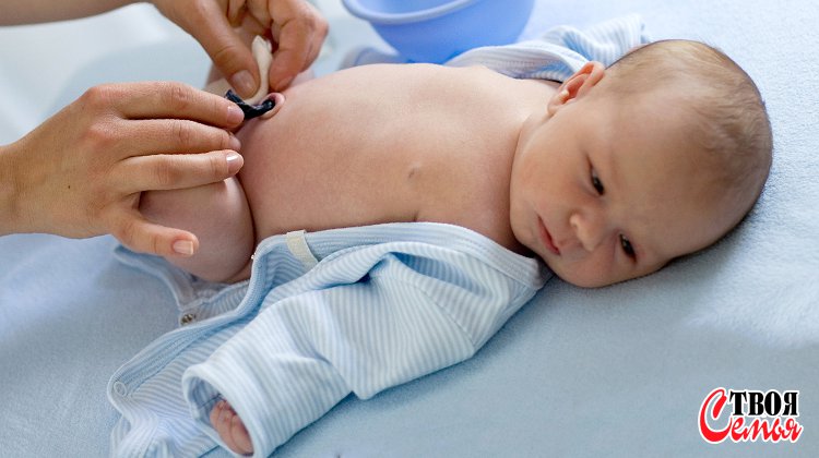 Изображение для статьи — Как ухаживать за пупком новорожденного, если вас рано выписали из роддома?